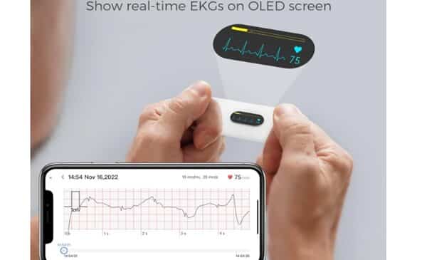 59,99€ électrocardiogramme électronique portable et connecté CheckMe DuoEK-S (-50%)